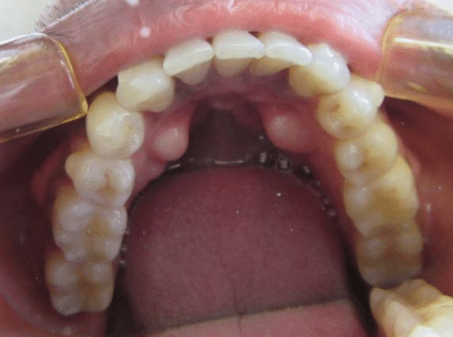 Smile Gallery. Dentist in Laguna Hills, CA. Dr. Marian Bradford, DDS. Premier Dental of South Orange County